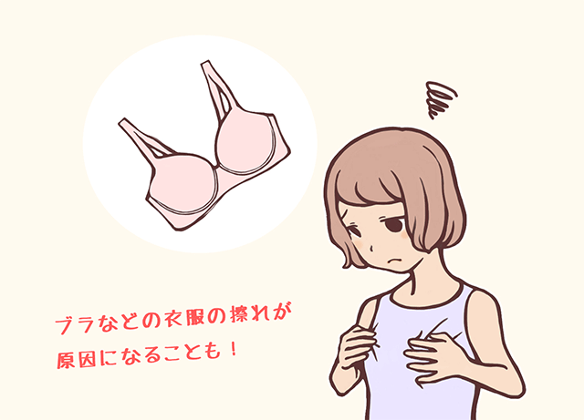 乳首は衣類の摩擦によるメラニン生成で黒くなる