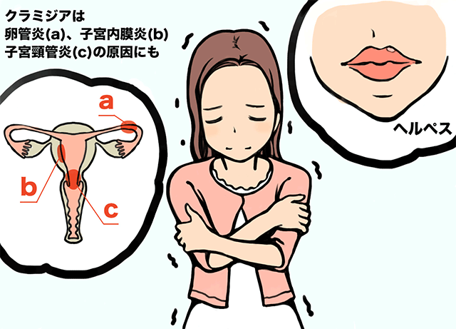 風俗嬢が感染しやすい性病